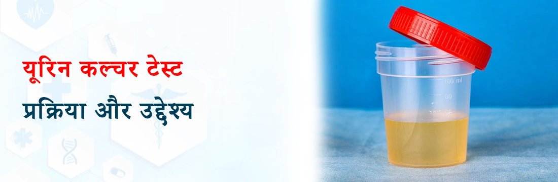 यूरिन कल्चर टेस्ट: प्रक्रिया और उद्देश्य